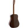 MARTIN HD-28-SUB-GE hd-28 1935 sunburst
